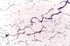 largerstainlees-steel-crack